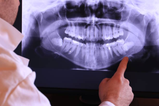 Best Urgent Care for Lost Fillings or Crowns in Spring Lake, NC